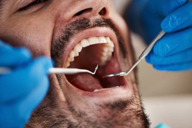 Laser Dentistry in Lamar, TX