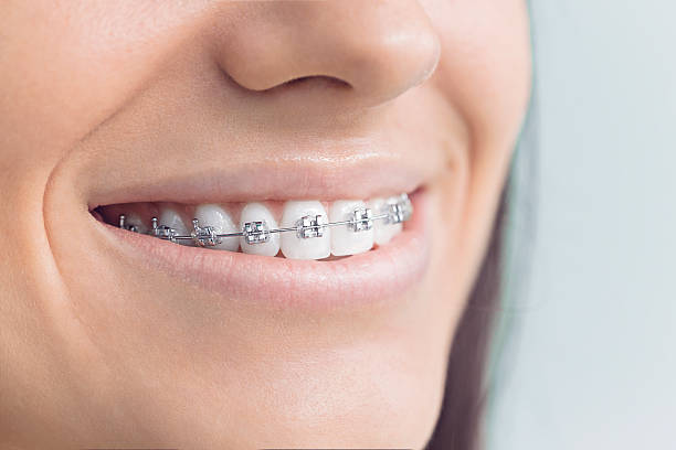 Best Dental Fillings (Composite and Amalgam)  in Lamar, TX